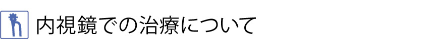 内視鏡での治療について